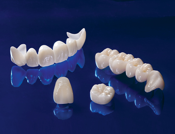  Couronnes en zircone – La solution idéale pour des dents fortes et naturelles à la clinique dentaire Revival